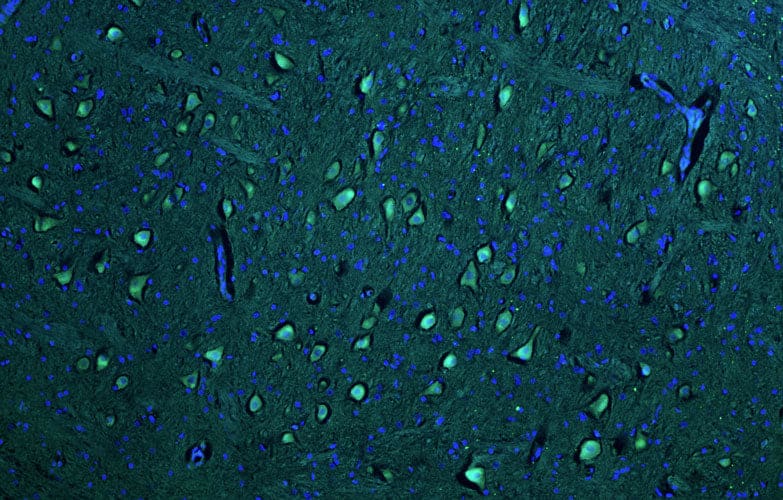Representative section of formalin fixed, paraffin-embedded rat brain stem neurons stained by NBP3-52368 using goat anti-chicken IgY secondary antibody (visualized in green). DAPI nuclear stain (blue) shows cell nuclei.