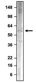 Western blotting of rat whole brain homogenate with NBP3-52368, and was detected with anti-chicken-HRP. This antibody recognizes endogenous PINK1 protein in rat whole brain homogenate.
