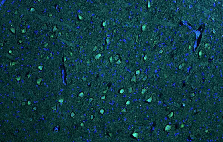 Representative section of formalin fixed, paraffin-embedded rat brain stem neurons stained by NBP3-52368 (the BSA Free version of this antibody) using goat anti-chicken IgY secondary antibody (visualized in green). DAPI nuclear stain (blue) shows cell nuclei.