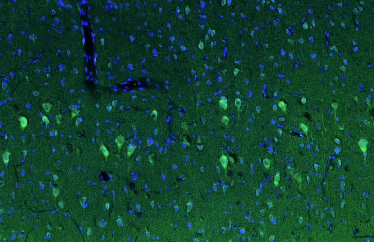 Representative section of formalin fixed, paraffin-embedded rat brain cortex stained by NBP3-52368 (the BSA Free version of this antibody) using goat anti-chicken IgY secondary antibody (visualized in green). DAPI nuclear stain (blue) shows cell nuclei.
