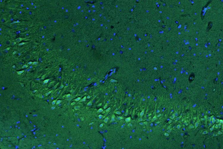 Representative section of formalin fixed, paraffin-embedded rat brain hippocampus stained by NBP3-52368 (the BSA Free version of this antibody) using goat anti-chicken IgY secondary antibody (visualized in green). DAPI nuclear stain (blue) shows cell nuclei.