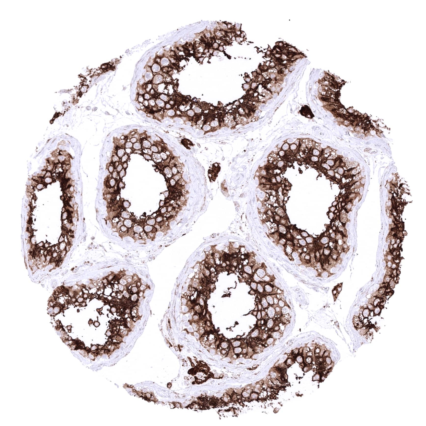 Leydig cells and spermatocytes of the testis show a particularly strong ACE2 immunostaining in the testis.