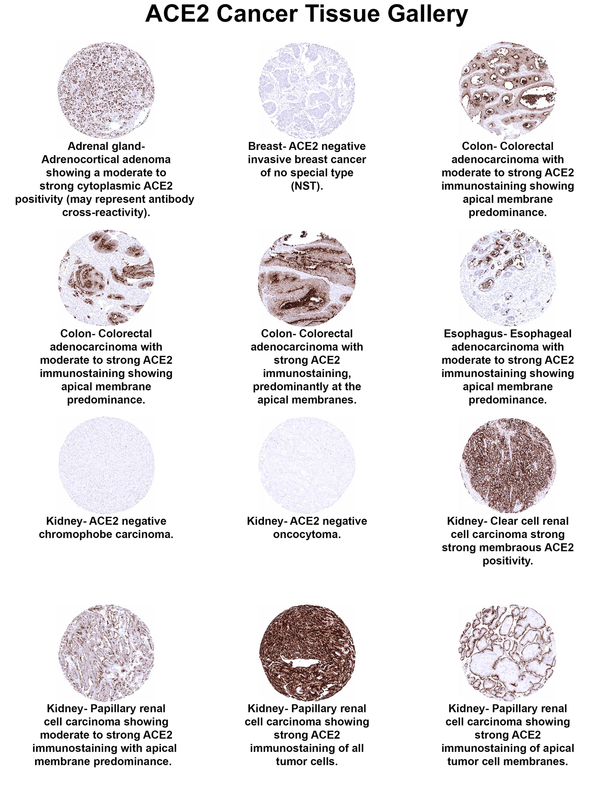 Immunohistochemistry ACE-2 Antibody (MSVA-919R)