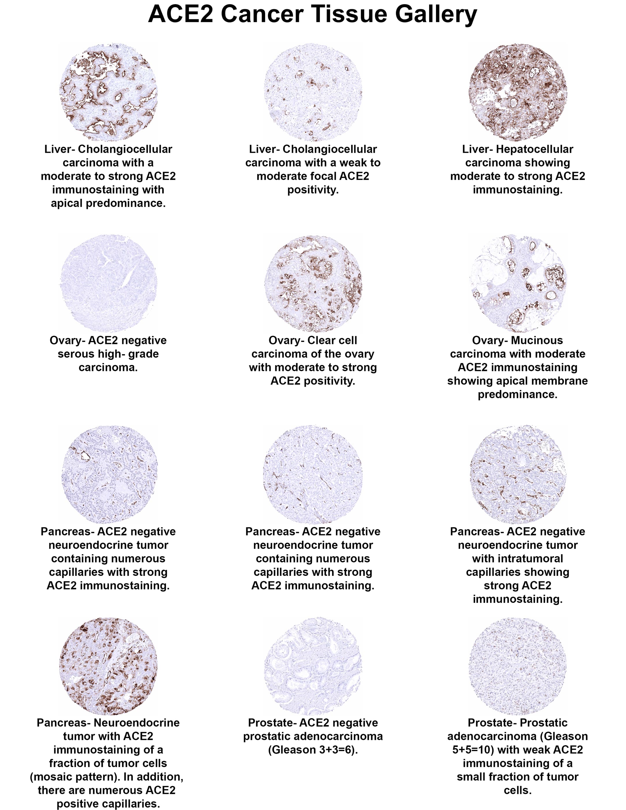 Immunohistochemistry ACE-2 Antibody (MSVA-919R)