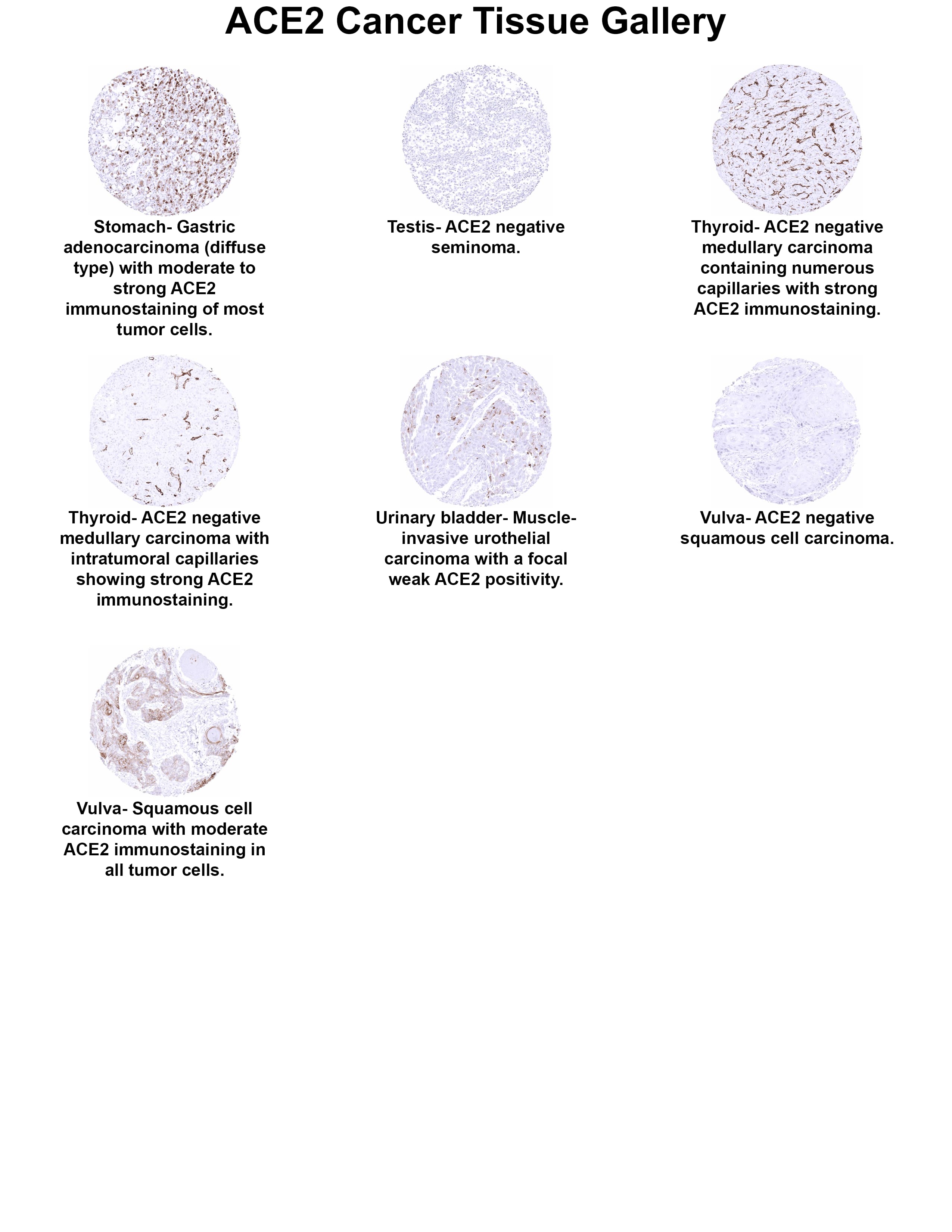 Immunohistochemistry ACE-2 Antibody (MSVA-919R)
