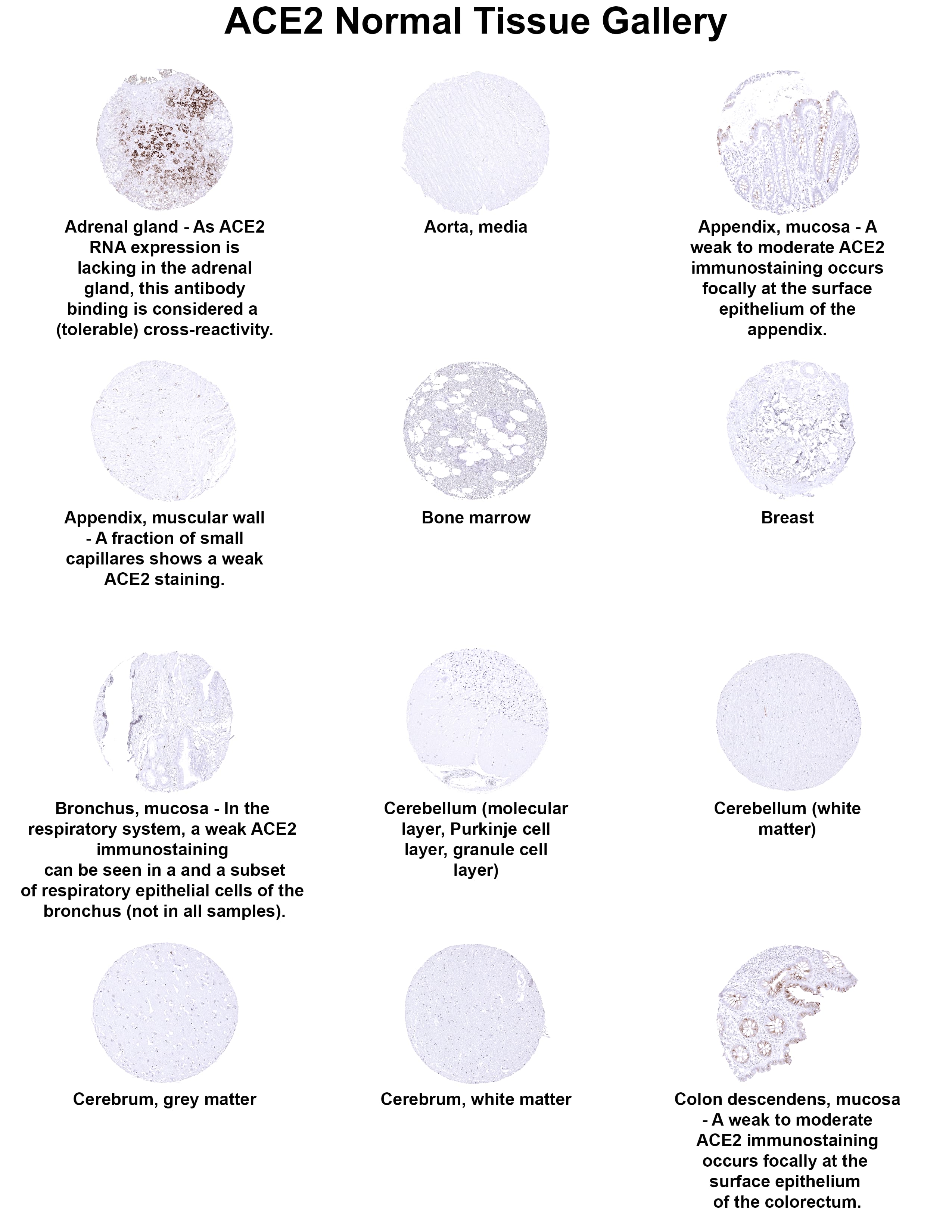Immunohistochemistry ACE-2 Antibody (MSVA-919R)