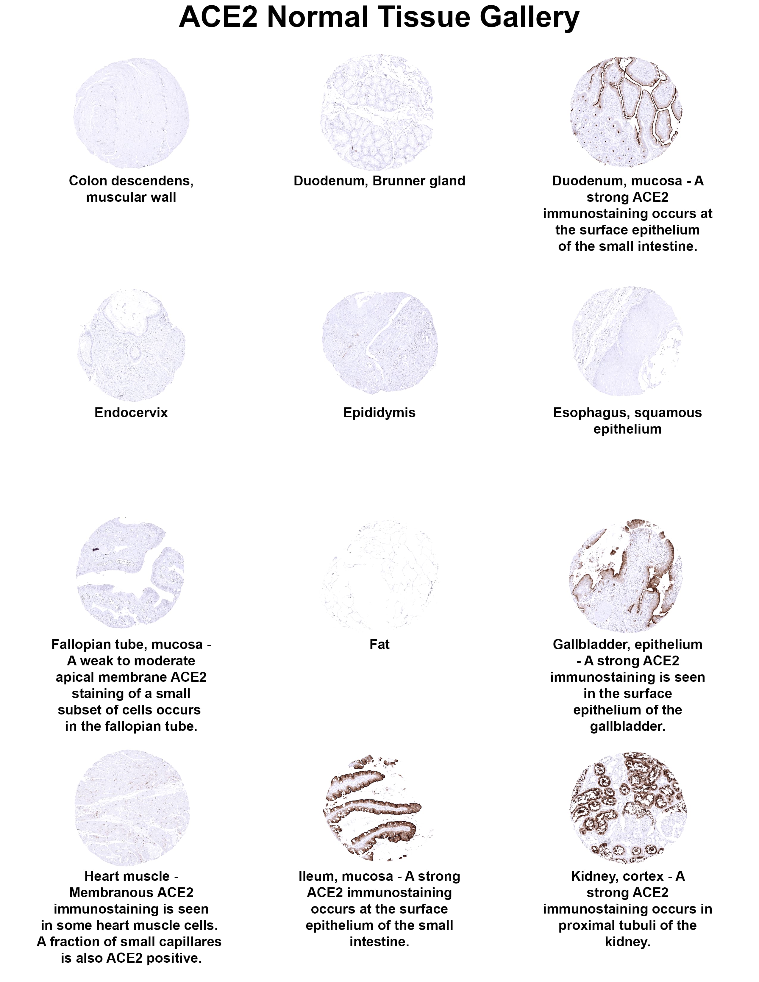 Immunohistochemistry ACE-2 Antibody (MSVA-919R)