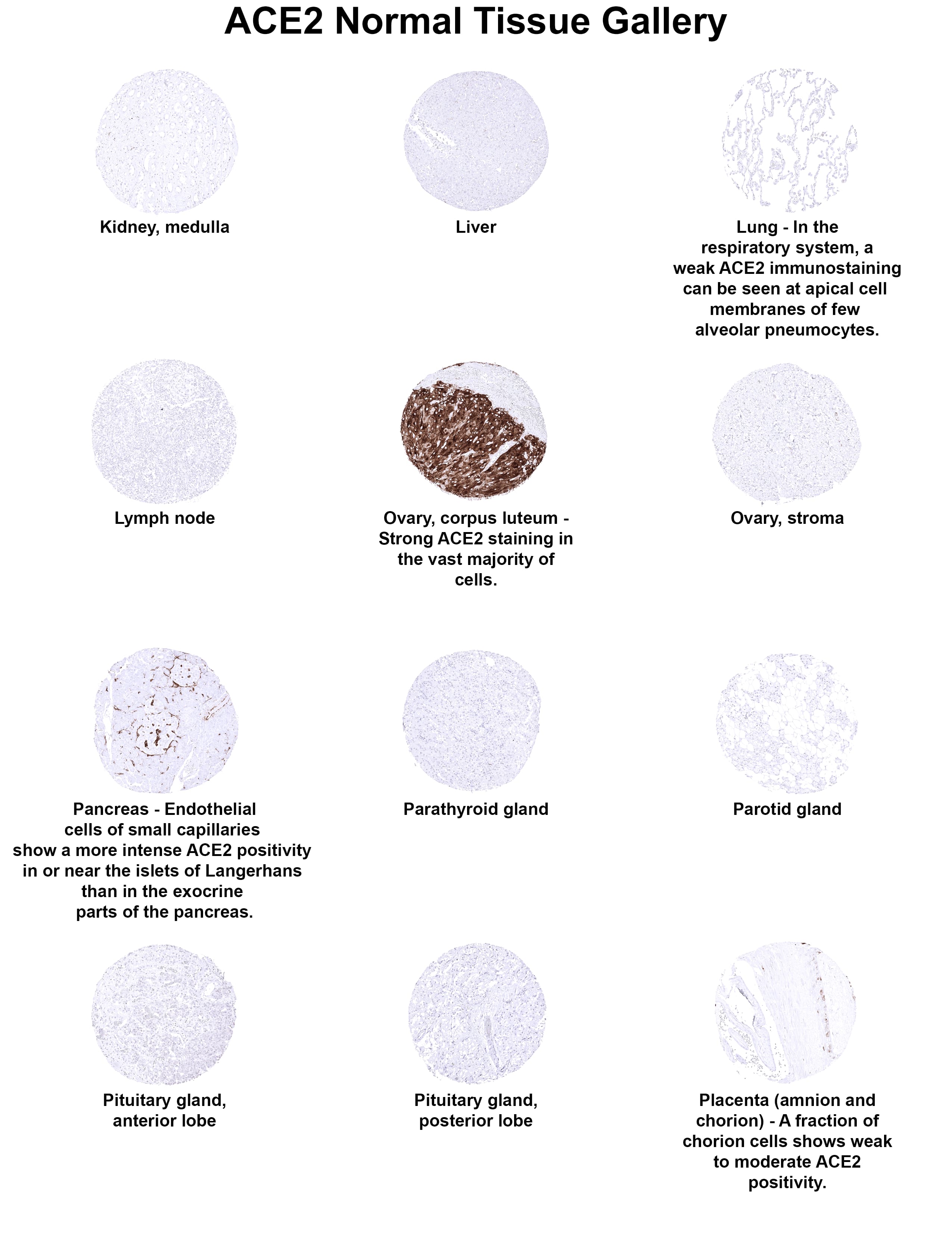Immunohistochemistry ACE-2 Antibody (MSVA-919R)
