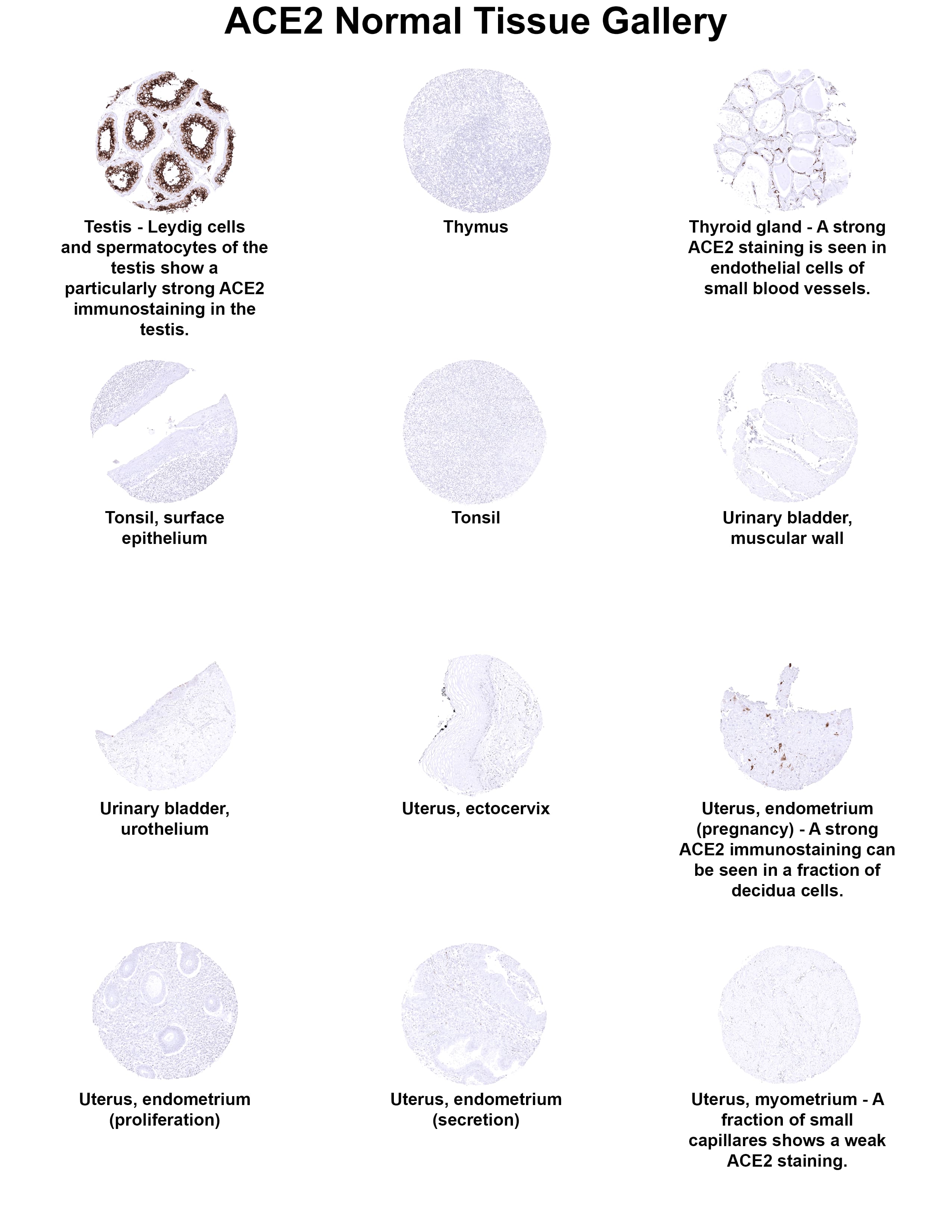 Immunohistochemistry ACE-2 Antibody (MSVA-919R)
