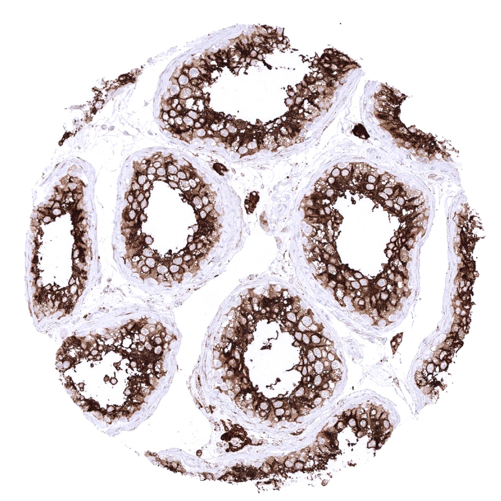 Leydig cells and spermatocytes of the testis show a particularly strong ACE2 immunostaining in the testis.