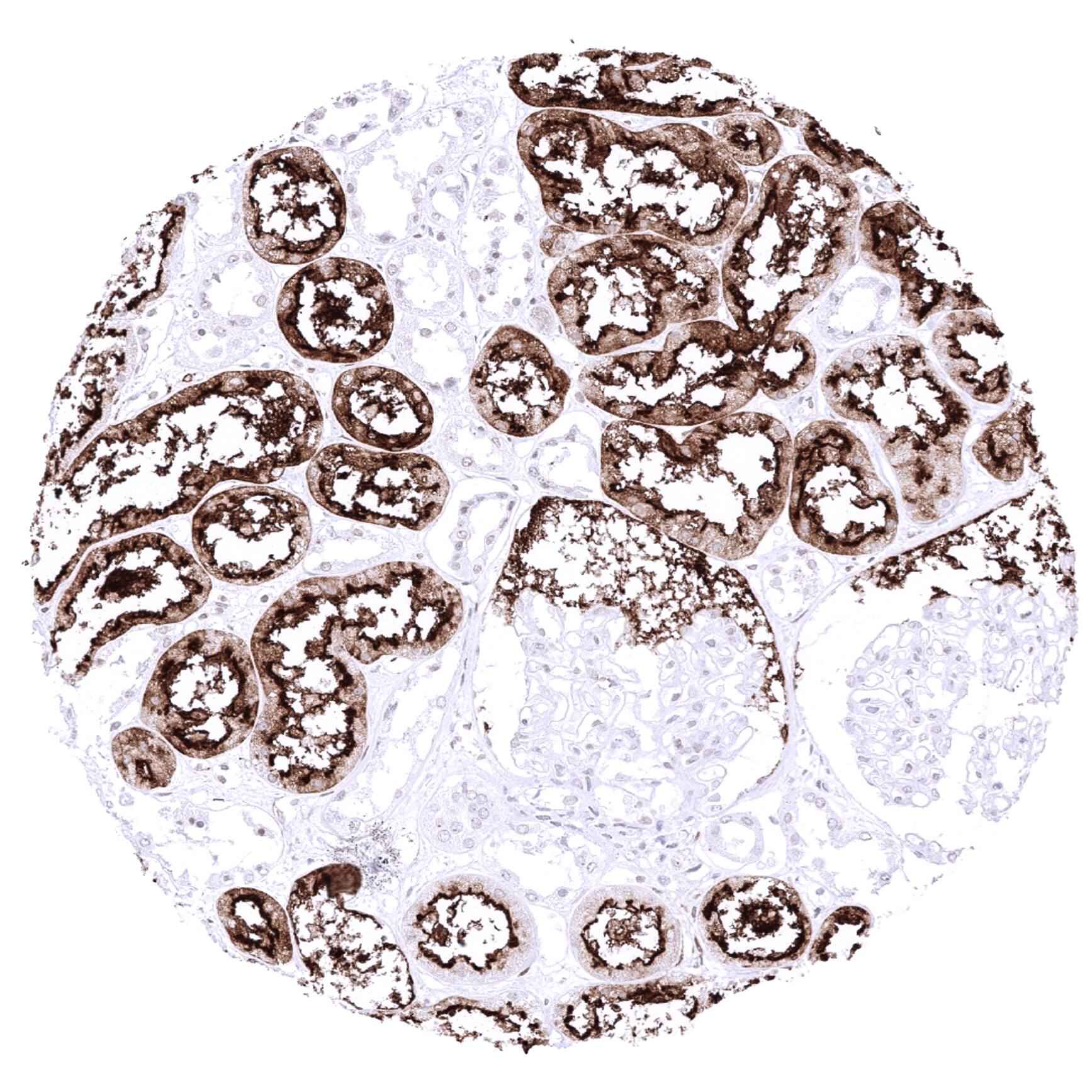 A strong ACE2 immunostaining occurs in proximal tubuli of the kidney.