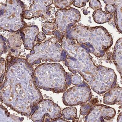 Immunohistochemistry-Paraffin: nef-associated protein 1 Antibody [NBP2-14424] - Staining of human placenta shows strong cytoplasmic positivity in trophoblastic cells.