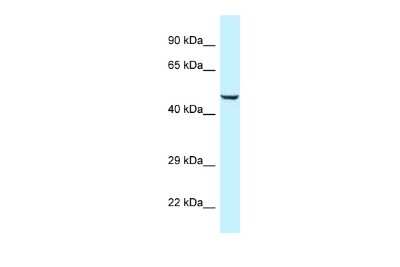 Western Blot: nef-associated protein 1 Antibody [NBP2-87896] - WB Suggested Anti-C9orf156 Antibody. Titration: 1.0 ug/ml. Positive Control: Fetal Heart