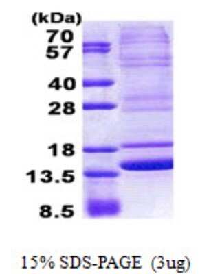 SDS-Page: neuromedin B Protein [NBP2-23280]