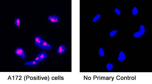 Detection of human Ki-67 by incubating cells with 3 μg/mL of Rabbit anti-Human Ki-67 monoclonal antibody (MAB7617) at room temperature for 1 hour followed by incubation with 1:200 dilution of Donkey Anti-Rabbit IgG NorthernLights™ NL557-conjugated secondary antibody for 1 hour at room temperature. Note strong positive staining in A172 cells (left panel, positive control) and a lack of non-specific background staining in the absence of primary antibodies (right panel, negative control).   