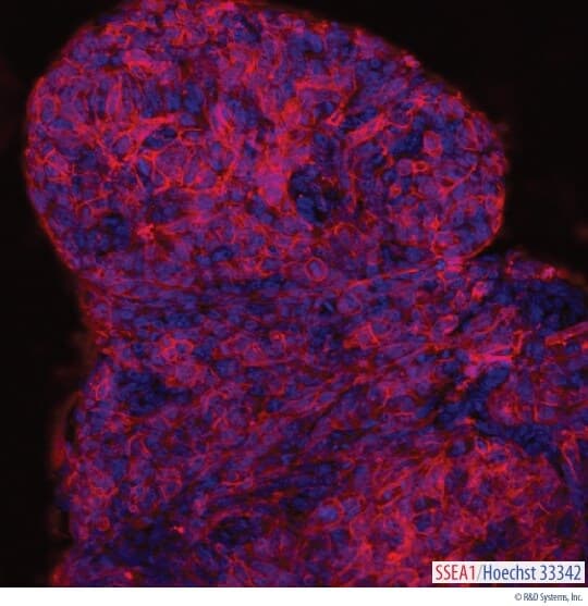 The stem cell marker SSEA-1 was visualized in live D3 mouse embryonic stem cells, grown on irradiated mouse embryonic fibroblasts (Catalog # PSC001), using a GloLIVE NL557-conjugated Anti-Human/Mouse SSEA-1 Monoclonal Antibody (Catalog # NLLC2155R; red). The nuclei were counterstained with Hoechst 33342 (blue). Positive staining for SSEA-1 in mouse stem cells is an indicator of pluripotency.