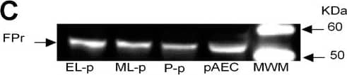 Presence of FPr in porcine corpora lutea-derived microvascular endothelial cells (pCL-MVECs) and porcine Aortic Endothelial Cells (pAECs). A) Relative FPr mRNA expression. The results are presented as Delta Ct (HPRT Ct - FPr Ct). B) FPr protein content. The results are presented as AU (arbitrary units). Data represent mean ± SD. Different letters indicate statistically significant differences (P < 0.05). C) Representative Western blotting of FPr.