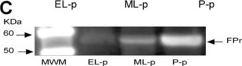 Presence of FPr in porcine corpora lutea (pCLs) at the early-luteal phase (EL-p), the mid-luteal phase (ML-p) and during pregnancy (P-p). A) Relative FPr mRNA expression. The results are presented as Delta Ct (HPRT Ct - FPr Ct). B) FPr protein content. The results are presented as AU (arbitrary units). Data represent mean ± SD. Different letters indicate statistically significant differences (P < 0.05). C) Representative Western blotting of FPr.