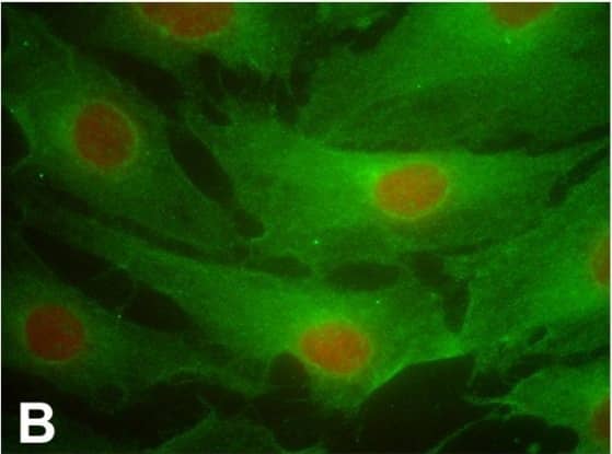 Immunocytochemistry/ Immunofluorescence: PTGFR Antibody - BSA Free [NLS1049] - Representative FPr immunofluorescent staining on porcine corpus luteum-microvascular endothelial cells (pCL-MVECs) isolated from the early luteal phase (EL-p) (A), the mid-luteal phase (ML-p) (B) & during pregnancy (P-p) (C) (×400). D) porcine Aortic Endothelial Cell (pAEC) culture (x400). Representative immunostaining of the FPr on non-fixed EL-p pCL-MVECs is shown (E). Image collected & cropped by CiteAb from the following publication (//rbej.biomedcentral.com/articles/10.1186/1477-7827-5-31), licensed under a CC-BY license. Not internally tested by Novus Biologicals.