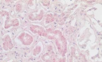 Immunohistochemistry-Paraffin: CXCR6 Antibody - BSA Free [NLS1102] - Immunohistochemistry of formalin-fixed, paraffin-embedded Human Kidney tissue