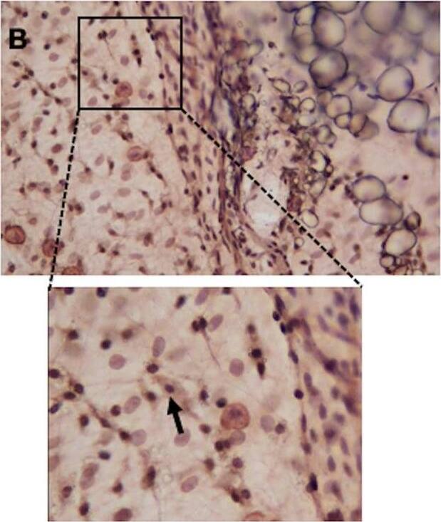 Nuclear localization of H2R. (A.1) Confocal images of LECs, labeled for Prox-1 (green channel), H2R (red channel), nuclei (DAPI) and overlay of all three channels. (A.2) Inset of one cell zoomed, which indicates the localization of H2R, Prox-1 and DAPI. (B) IHC staining performed on the rat perilymphatic tissue. The tissue was stained with H2R antibody, showing its nuclear localization; the inset zoomed view shows the localization pattern. Images are representative of at least three independent experiments. Scale bar: 20 um. Image collected and cropped by CiteAb from the following open publication (//pubmed.ncbi.nlm.nih.gov/35776777), licensed under a CC-BY license. Not internally tested by Novus Biologicals.