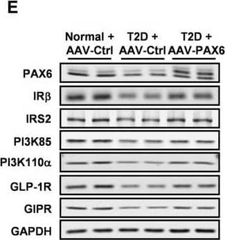 Western Blot GLP-1R Antibody - BSA Free