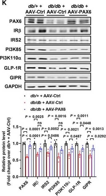 Western Blot GLP-1R Antibody - BSA Free