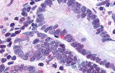 Immunohistochemistry-Paraffin: GLP-2R Antibody - BSA Free [NLS1312] - Immunohistochemistry of formalin-fixed, paraffin-embedded human small intestine, neuroendocrine cells tissue after heat-induced antigen retrieval.