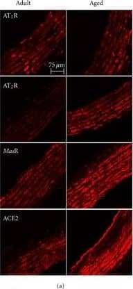 Immunocytochemistry/ Immunofluorescence: Mas Antibody - BSA Free [NLS1531] -  (a) Representative immunolocalisation images of AT1R, AT2R, MasR, & ACE2 in adult WKY rats & aged WKY rats. Mean data for aortic expression of the (b) AT1R, (c) AT2R, (d) MasR, & (e) ACE2 expressed as relative fluorescent units in adult (n = 5) & aged (n = 4) WKY rats. ***P < 0.001 versus adult WKY rats. Image collected & cropped by CiteAb from the following publication (//pubmed.ncbi.nlm.nih.gov/22187625), licensed under a CC-BY license. Not internally tested by Novus Biologicals.