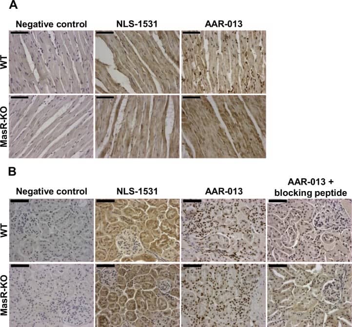 Immunohistochemistry: Mas Antibody - BSA Free [NLS1531] - Immunohistochemistry in heart & kidney from wild-type (WT) & MasR-KO mice.Negative controls performed by omitting the primary antibody demonstrated minimal background immunostaining in heart (A) & kidney (B) sections. (A) In heart sections, NLS-1531 antibody stained predominantly the cytoplasm of cardiomyocytes with similar intensity in WT & MasR-KO hearts. The AAR-013 antibody stained the cardiomyocytes nucleus & weaker staining was observed in their cytoplasm. The same pattern was found in heart sections of MasR-KO mice. (B) In kidney sections, for NLS-1531 antibody, staining was mostly restricted to cytoplasm of numerous tubules cells with similar intensity in WT & MasR-KO kidneys. Antibody AAR-013 stained most intensely tubules cells nucleus & weaker staining was observed in their cytoplasm. Glomeruli were also stained positively. The same pattern was found in kidney sections of MasR-KO. Preincubation of the AAR-013 antibody with the blocking peptide provided by the vendors eliminated the immunohistochemical nuclear staining both in WT & MasR-KO mice kidney sections. Images are representative of n = 3. Bar, 50 μm. Image collected & cropped by CiteAb from the following publication (//dx.plos.org/10.1371/journal.pone.0183278), licensed under a CC-BY license. Not internally tested by Novus Biologicals.