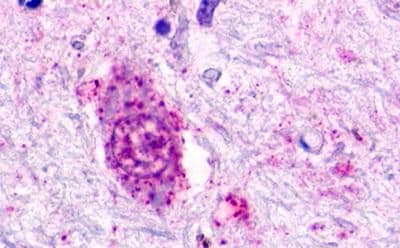Immunohistochemistry: GPR84 Antibody - BSA Free [NLS344] - Immunohistochemistry of Brain, substantia nigra