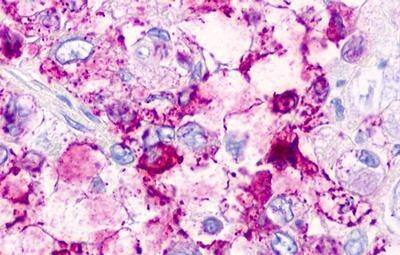 Immunohistochemistry TAAR2 Antibody - BSA Free