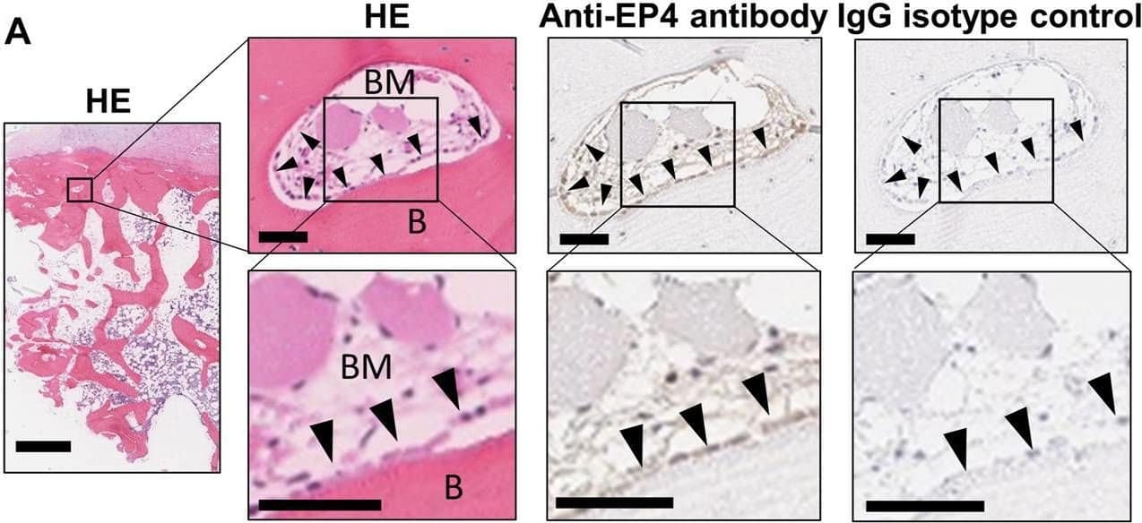 Histological images of human bone and extracted samples. (A) Representative images of hematoxylin and eosin (HE) staining, and anti-EP4 and IgG control immunostaining of human vertebral bone. Arrowheads indicate representative anti-EP4 immunostaining-positive osteoblasts. B, Bone; BM, bone marrow. Scale bars, 1 mm (low magnification), 50 μm (medium magnification), and 50 μm (high magnification). (B) Representative images of HE staining and anti-human vimentin, anti-rat osteocalcin, anti-human osteocalcin immunostaining. Boundary lines of new bone are drawn on HE staining. Arrowheads indicate representative immunostaining-positive cells. XB, xenografted bone; NB, new bone; BM, bone marrow (stroma between xenografted bone). Scale bars, 500 μm (low magnification) and 200 μm (high magnification). Image collected and cropped by CiteAb from the following open publication (//pubmed.ncbi.nlm.nih.gov/35372320), licensed under a CC-BY license. Not internally tested by Novus Biologicals.