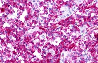 Immunohistochemistry: GPR176 Antibody - BSA Free [NLS401] - Immunohistochemistry of Brain, Pituitary, pars anterior