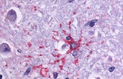 Immunohistochemistry: Dopamine D1R/DRD1 Antibody - BSA Free [NLS43] - Immunohistochemistry of Brain, Alzheimer's protoplasmic astrocyte