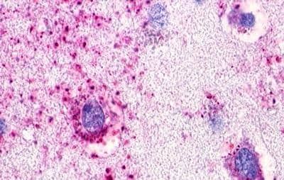 Immunohistochemistry: SREB3 Antibody - BSA Free [NLS516] - Immunohistochemistry of Brain, Cortex, Neurons and glia