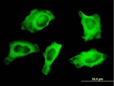 Immunocytochemistry/Immunofluorescence: non-muscle Myosin IIA Antibody (1H6) [H00004627-M05] - Analysis of monoclonal antibody to MYH9 on HeLa cell. Antibody concentration 10 ug/ml