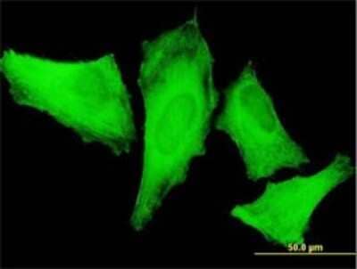 Immunocytochemistry/Immunofluorescence: non-muscle Myosin IIA Antibody (4D1) [H00004627-M04] - Analysis of monoclonal antibody to MYH9 on HeLa cell. Antibody concentration 10 ug/ml