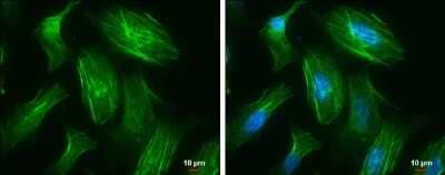 Immunocytochemistry/Immunofluorescence: non-muscle heavy chain 10 Myosin Antibody (GT246) [NBP3-13591] - non-muscle heavy chain 10 Myosin antibody [GT246] detects non-muscle heavy chain 10 Myosin protein at cytoskeleton by immunofluorescent analysis. Sample: HeLa cells were fixed in 4% paraformaldehyde at RT for 15 min. Green: non-muscle heavy chain 10 Myosin protein stained by non-muscle heavy chain 10 Myosin antibody [GT246] (NBP3-13591) diluted at 1:500. Blue: Hoechst 33342 staining. Scale bar = 10 um.