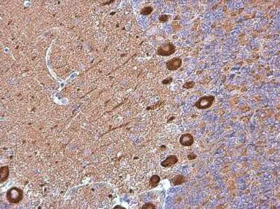 Immunohistochemistry-Paraffin: non-muscle heavy chain 10 Myosin Antibody (GT324) [NBP3-13583] - non-muscle heavy chain 10 Myosin antibody [GT324] detects non-muscle heavy chain 10 Myosin protein at cytoplasm in rat brain by immunohistochemical analysis. Sample: Paraffin-embedded rat brain. non-muscle heavy chain 10 Myosin antibody [GT324] (NBP3-13583) diluted at 1:200. Antigen Retrieval: Citrate buffer, pH 6.0, 15 min