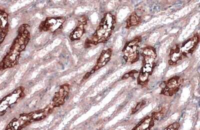 Immunohistochemistry-Paraffin: non-muscle heavy chain 10 Myosin Antibody (GT324) [NBP3-13583] - non-muscle heavy chain 10 Myosin antibody [GT324] detects non-muscle heavy chain 10 Myosin protein at cell membrane and cytoplasm by immunohistochemical analysis. Sample: Paraffin-embedded rat kidney. non-muscle heavy chain 10 Myosin stained by non-muscle heavy chain 10 Myosin antibody [GT324] (NBP3-13583) diluted at 1:200. Antigen Retrieval: Citrate buffer, pH 6.0, 15 min