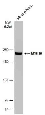 Western Blot: non-muscle heavy chain 10 Myosin Antibody (GT324) [NBP3-13583] - Mouse tissue extract (50 ug) was separated by 5% SDS-PAGE, and the membrane was blotted with non-muscle heavy chain 10 Myosin antibody [GT324] (NBP3-13583) diluted at 1:5000. The HRP-conjugated anti-mouse IgG antibody (NBP2-19382) was used to detect the primary antibody.