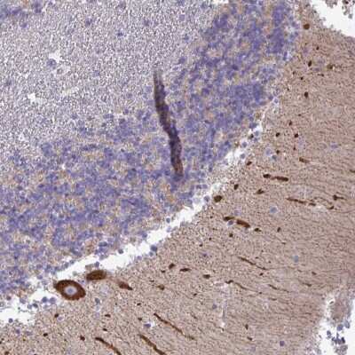 Immunohistochemistry: non-muscle heavy chain 10 Myosin Antibody [NBP2-38824] - Staining of human cerebellum shows strong cytoplasmic positivity in Purkinje cells.