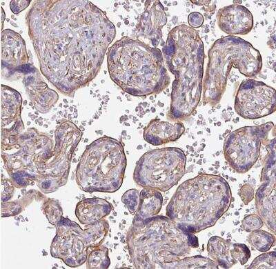 Immunohistochemistry-Paraffin: non-muscle heavy chain 10 Myosin Antibody [NBP2-38566] - Staining of human placenta shows moderate membranous positivity in trophoblastic cells.