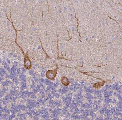 Immunohistochemistry-Paraffin: non-muscle heavy chain 10 Myosin Antibody [NBP2-38566] - Staining of human cerebellum shows weak to moderate cytoplasmic positivity in Purkinje cells.