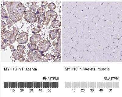 Immunohistochemistry-Paraffin: non-muscle heavy chain 10 Myosin Antibody [NBP2-38566] - Analysis in human placenta and skeletal muscle tissues. Corresponding MYH10 RNA-seq data are presented for the same tissues.