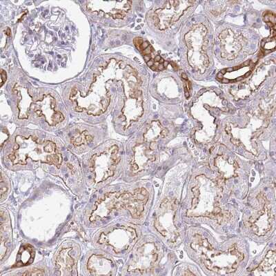 Immunohistochemistry-Paraffin: non-muscle heavy chain 10 Myosin Antibody [NBP2-38566] - Staining of human kidney shows moderate membranous positivity in cells in tubules.