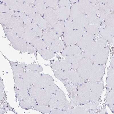 Immunohistochemistry-Paraffin: non-muscle heavy chain 10 Myosin Antibody [NBP2-38824] - Staining of human skeletal muscle shows low expression as expected.