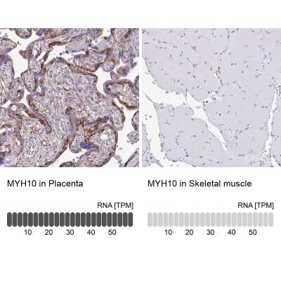 <b>Orthogonal Strategies Validation. </b>Immunohistochemistry-Paraffin: non-muscle heavy chain 10 Myosin Antibody [NBP2-38824] - Staining in human placenta and skeletal muscle tissues using anti-MYH10 antibody. Corresponding MYH10 RNA-seq data are presented for the same tissues.