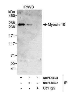 Immunoprecipitation: non-muscle heavy chain 10 Myosin Antibody [NBP1-18931] - Detection of human Myosin-10 by western blot of immunoprecipitates. Samples: Whole cell lysate (1 mg for IP, 20% of IP loaded) from HeLa cells. Antibodies: Affinity purified rabbit anti-Myosin-10 antibody NBP1-18931 used for IP at 3 ug/mg lysate. Myosin-10 was also immunoprecipitated by rabbit anti-Myosin-10 antibody NBP1-18932, which recognizes a downstream epitope. For blotting immunoprecipitated Myosin-10, NBP1-18931 was used at 1 ug/ml. Detection: Chemiluminescence with an exposure time of 3 minutes.